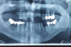 FIG.2