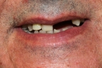 FIG.1