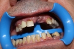 FIG.3 (Visione intraorale)