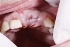 FIG.4