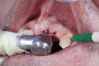 FIG.7