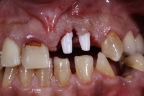 FIG. 12 (visione vestibolare)