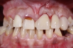 FIG.15