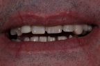 FIG.16