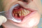 FIG.1