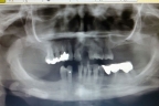 FIG.4