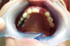 FIG.2 (visione occlusale)