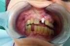 FIG.6